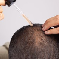 Trichology Treatments (Hair)